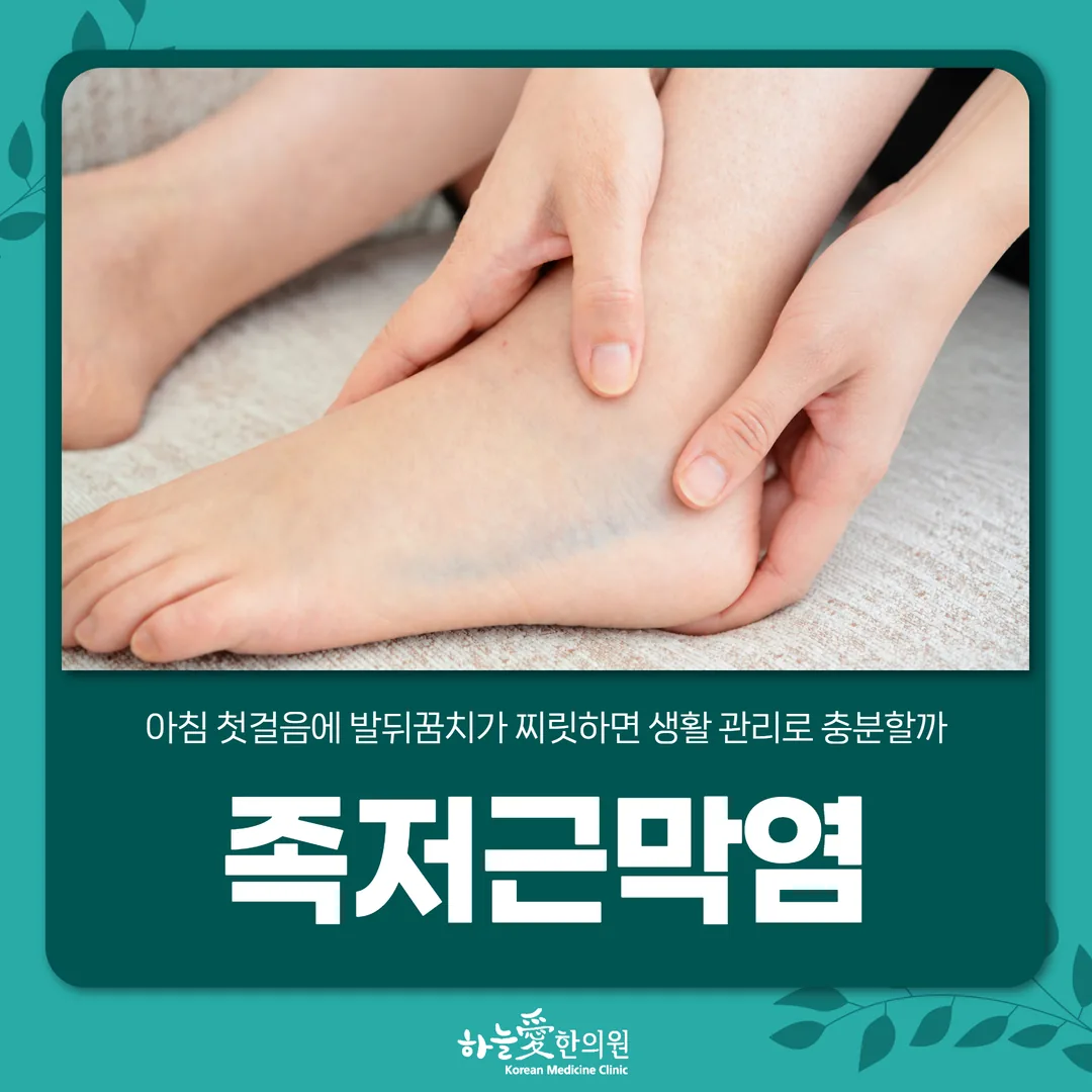 족저근막염, 아침 첫걸음에 발뒤꿈치가 찌릿하면 생활 관리로 충분할까